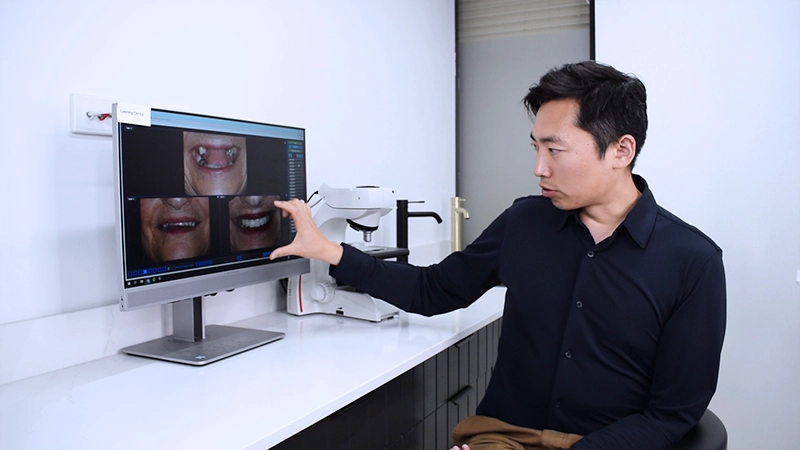 All-on-4® Full-Arch Implants